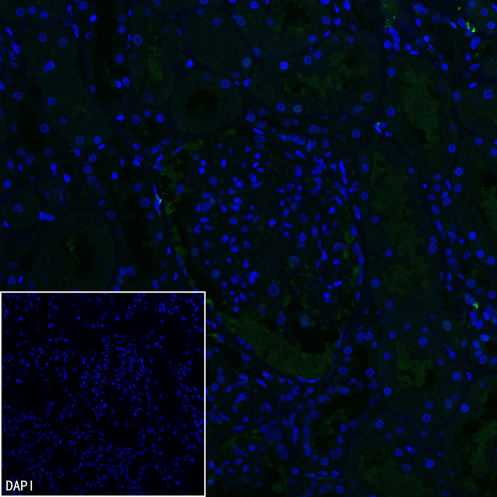 Inhibin alpha Recombinant Rabbit mAb (SDT-3212-24)