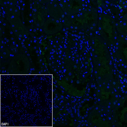 Inhibin alpha Recombinant Rabbit mAb (SDT-3212-24)
