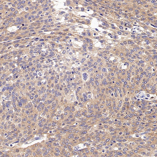 PI3 Kinase p85 beta Recombinant Rabbit mAb (S-1058-266)