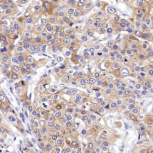 ZO-1 Recombinant Rabbit mAb (S-2188-12)