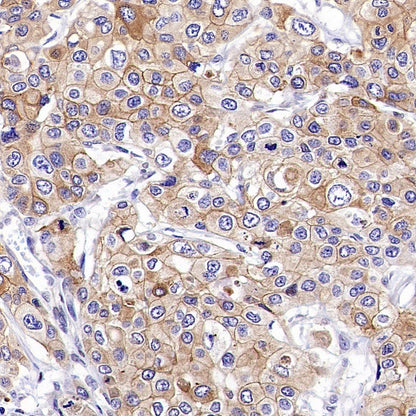 ZO-1 Recombinant Rabbit mAb (S-2188-12)