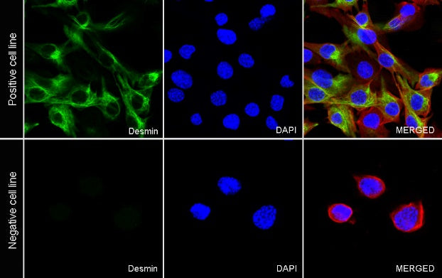 S-RMab® Desmin Recombinant Rabbit mAb (SDT-109-114)