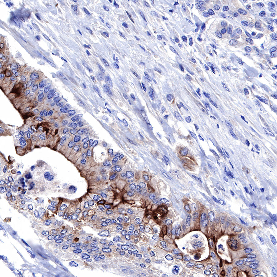 S-RMab® Mesothelin Recombinant Rabbit mAb (SDT-R070)