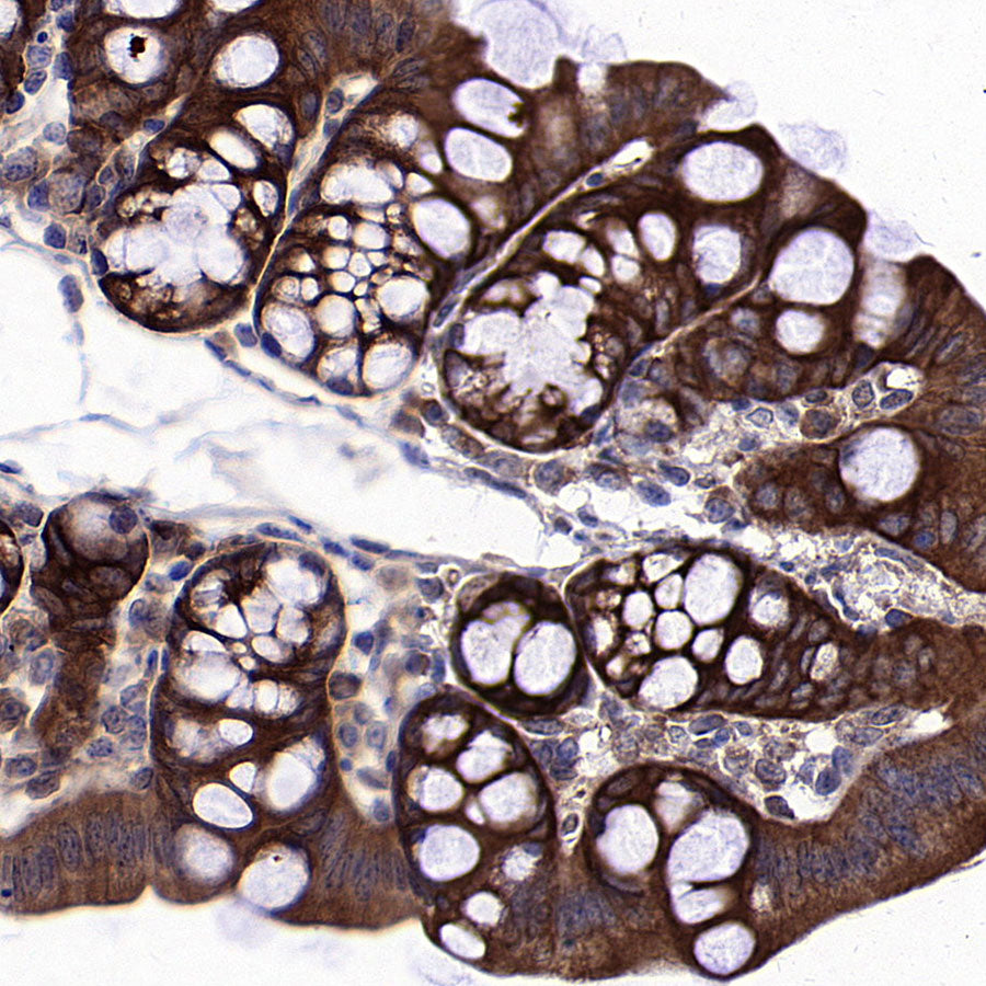 HSP90 alpha/beta Recombinant Mouse mAb (S-5282)