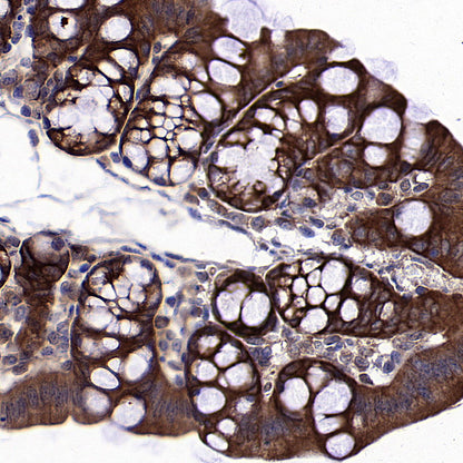 HSP90 alpha/beta Recombinant Mouse mAb (S-5282)