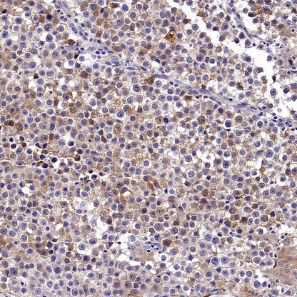 LIN28A Rabbit Polyclonal Antibody