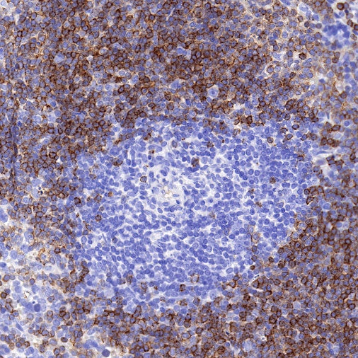 S-RMab® CD79B Recombinant Rabbit mAb (SDT-R513)