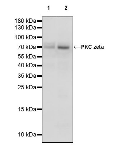 PKC zeta Recombinant Rabbit mAb (S-1306-34)