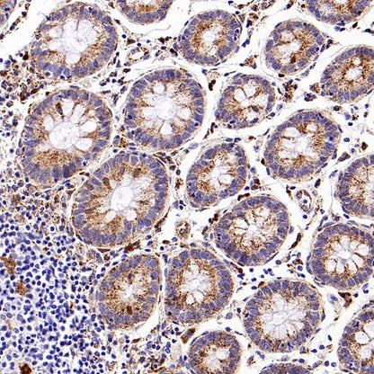 GBA Recombinant Rabbit mAb (S-3211-14)