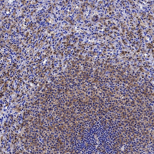 PKC delta Recombinant Rabbit mAb (S-2611-39)