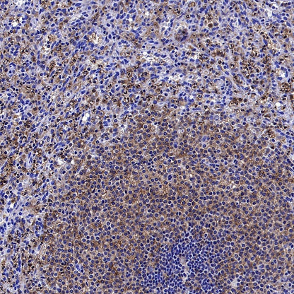PKC delta Recombinant Rabbit mAb (S-2611-39)