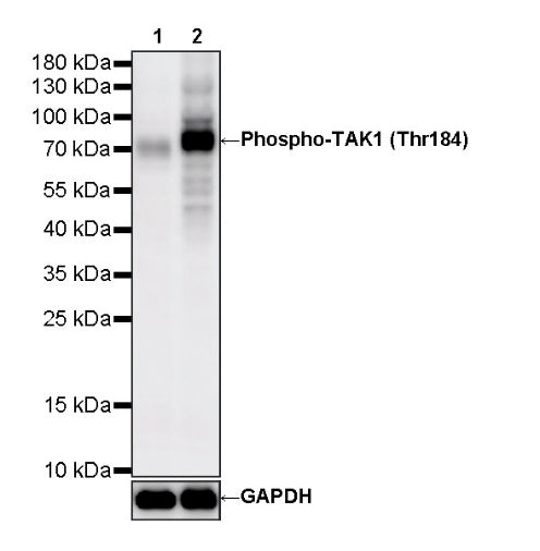 Phospho-TAK1 (Thr184) Recombinant Rabbit mAb (S-3526-6)