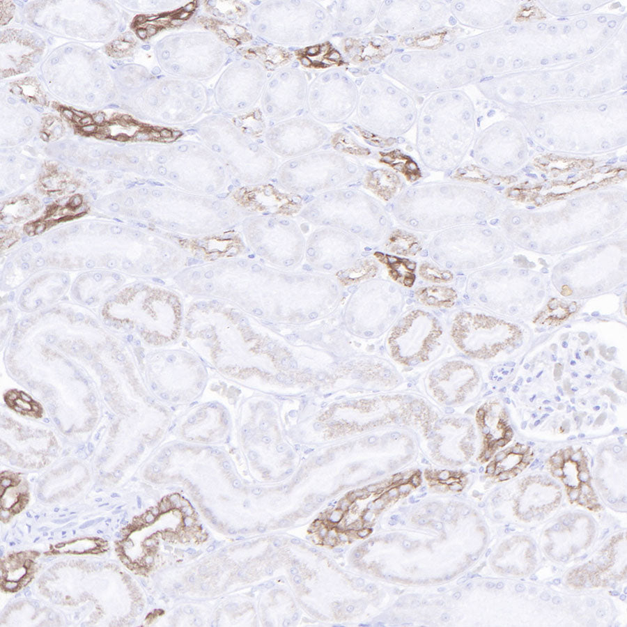S-RMab® CK-Pan Recombinant Rabbit mAb (SDT-P001)