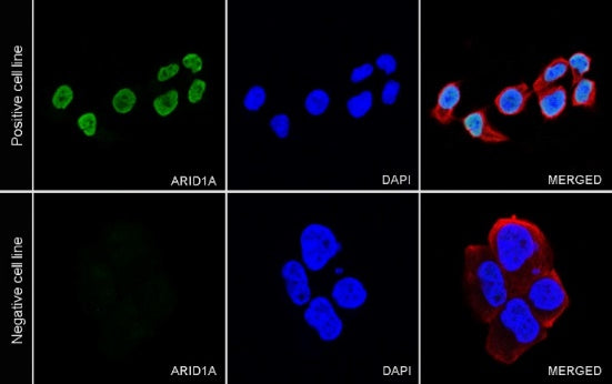 ARID1A Recombinant Rabbit mAb (S-440-27)