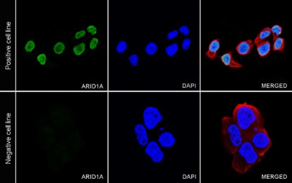 ARID1A Recombinant Rabbit mAb (S-440-27)