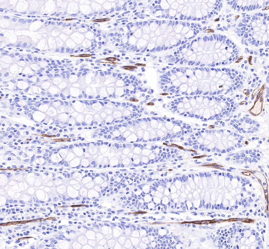 CD34 Recombinant Rabbit mAb,PBS Only (SDT-051-68)