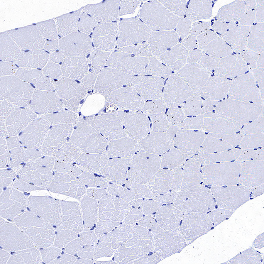 CDCP1 Recombinant Rabbit mAb (S-3437-221)
