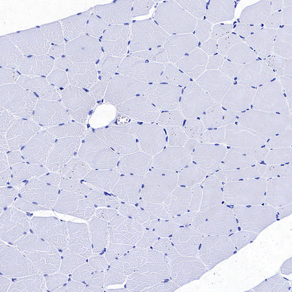 CDCP1 Recombinant Rabbit mAb (S-3437-221)