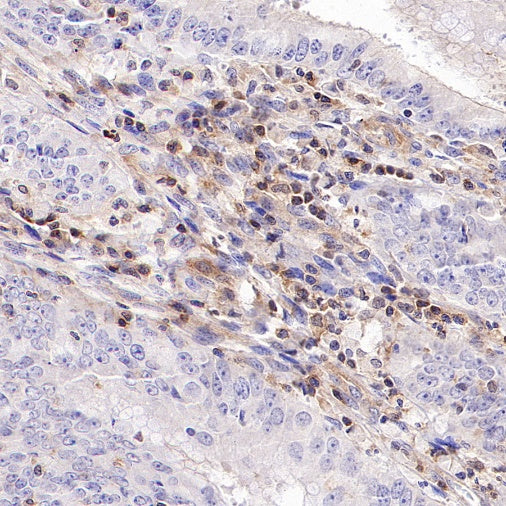 IRF-5 Recombinant Rabbit mAb (S-3056-28)
