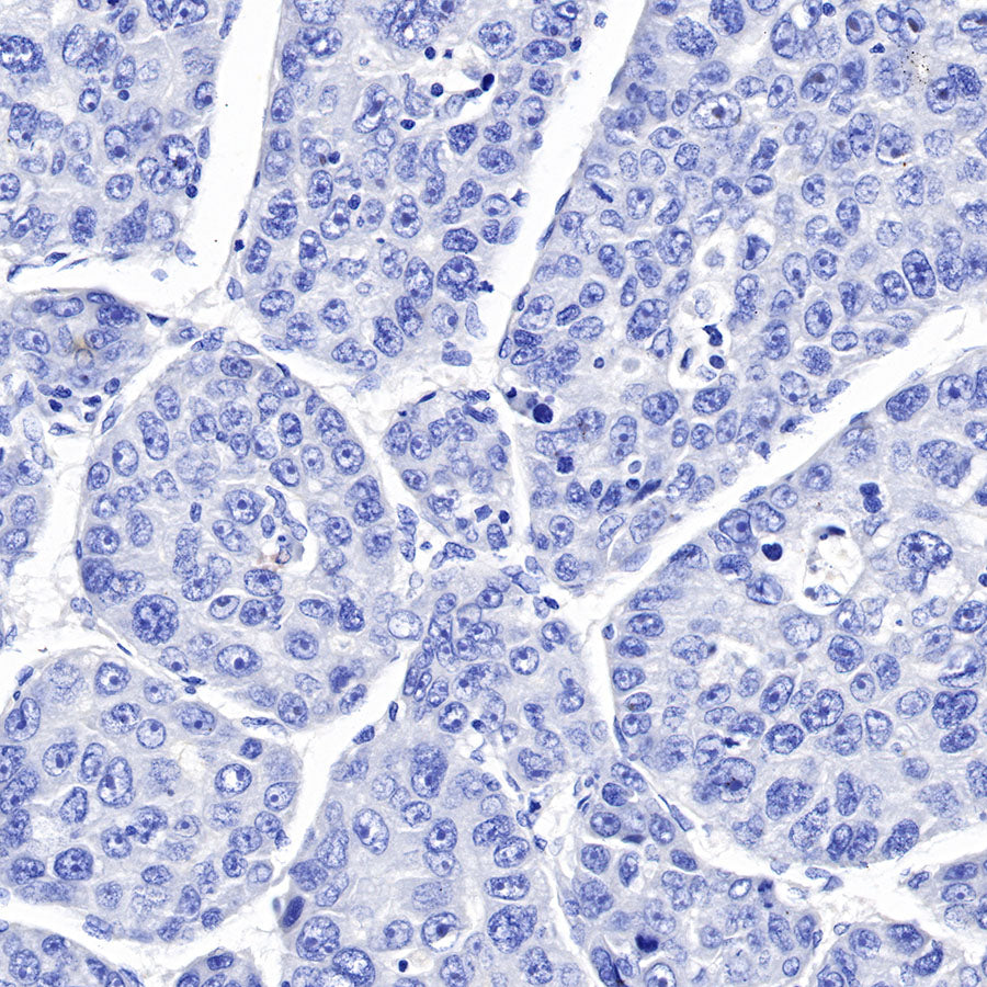 S-RMab® CK5/6 Recombinant Rabbit mAb,PBS Only (SDT-P004)