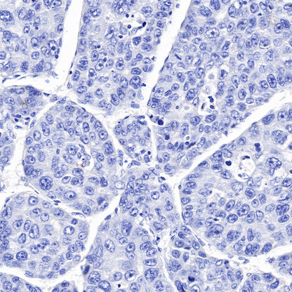 S-RMab® CK5/6 Recombinant Rabbit mAb,PBS Only (SDT-P004)