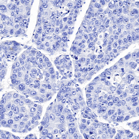 S-RMab® CK5/6 Recombinant Rabbit mAb,PBS Only (SDT-P004)