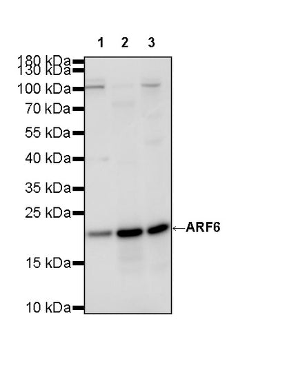ARF6 Recombinant Rabbit mAb (S-4283-62)