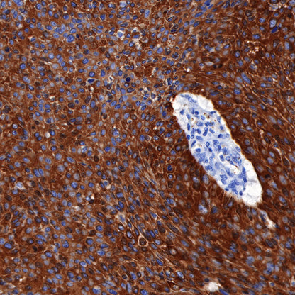 S-RMab® CK5/6 Recombinant Rabbit mAb,PBS Only (SDT-P004)