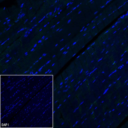 NeuroD2 Recombinant Rabbit mAb (S-3092-64)