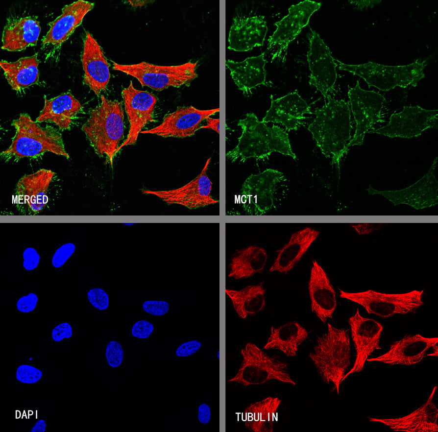 MCT1/Monocarboxylic acid transporter 1 Recombinant Rabbit mAb (S-5144)
