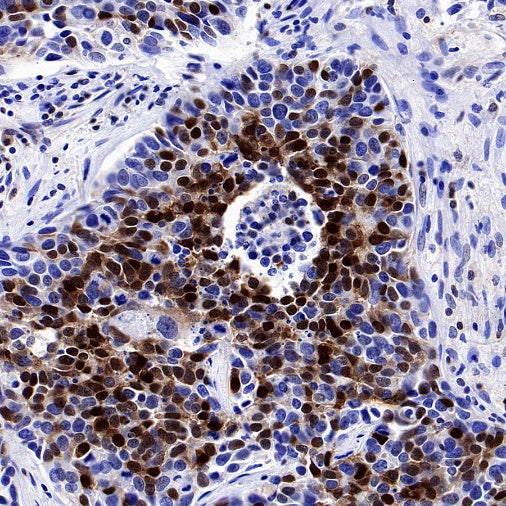 p27 Kip1 Recombinant Rabbit mAb (SDT-361-310)