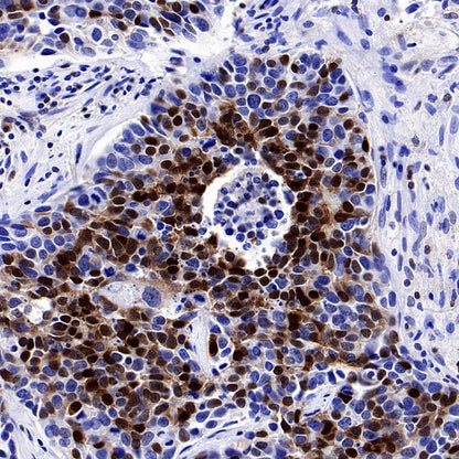 p27 Kip1 Recombinant Rabbit mAb (SDT-361-310)