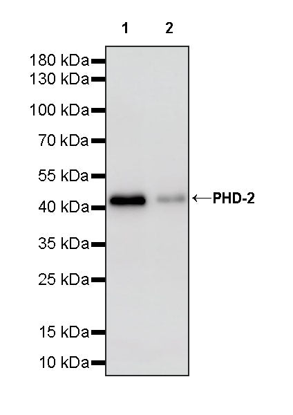 PHD-2 Recombinant Rabbit mAb (S-4111-17)