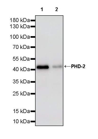 PHD-2 Recombinant Rabbit mAb (S-4111-17)