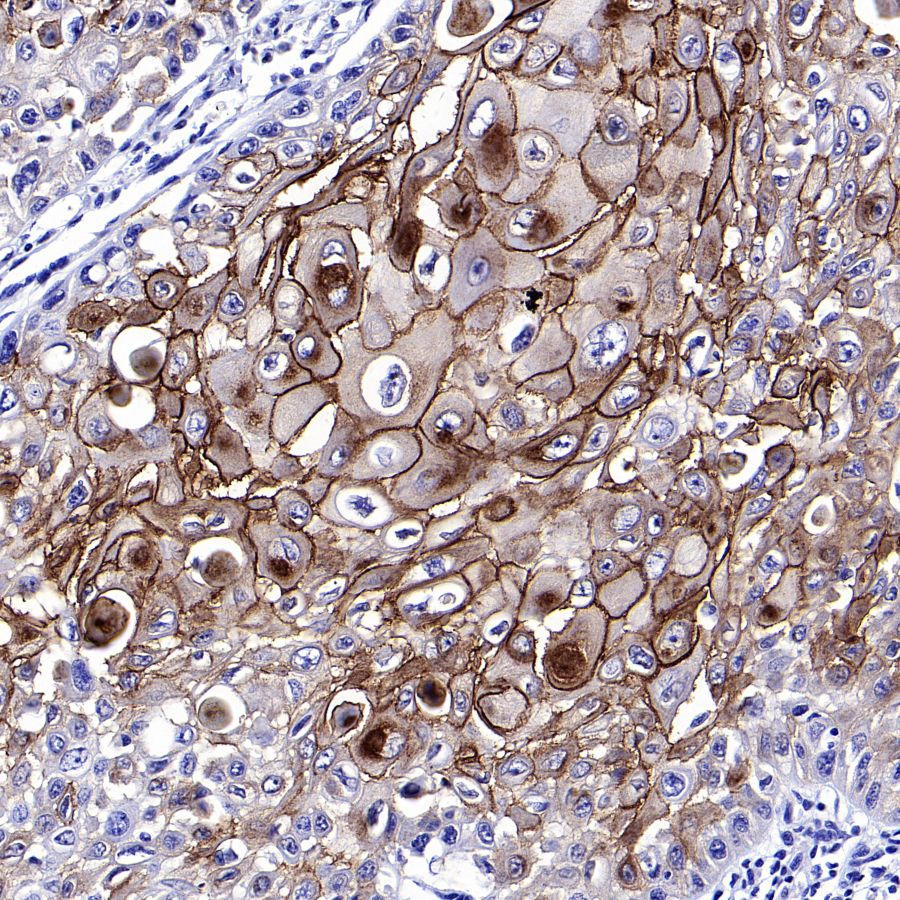 Desmocollin-2/3(DSC2/3) Recombinant Rabbit mAb (SDT-2102-59)