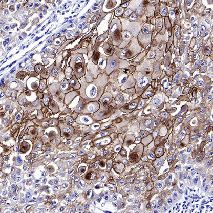 Desmocollin-2/3(DSC2/3) Recombinant Rabbit mAb (SDT-2102-59)
