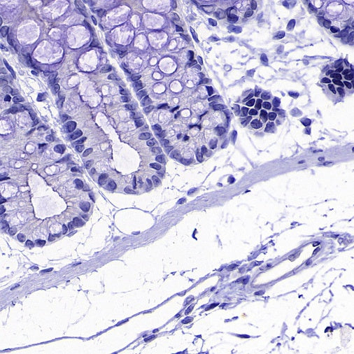 Coagulation factor V Recombinant Rabbit mAb (S-4489-58)