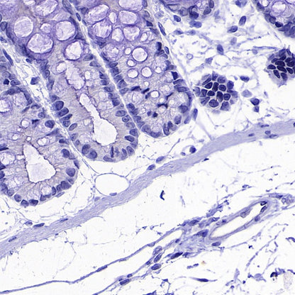 Coagulation factor V Recombinant Rabbit mAb (S-4489-58)