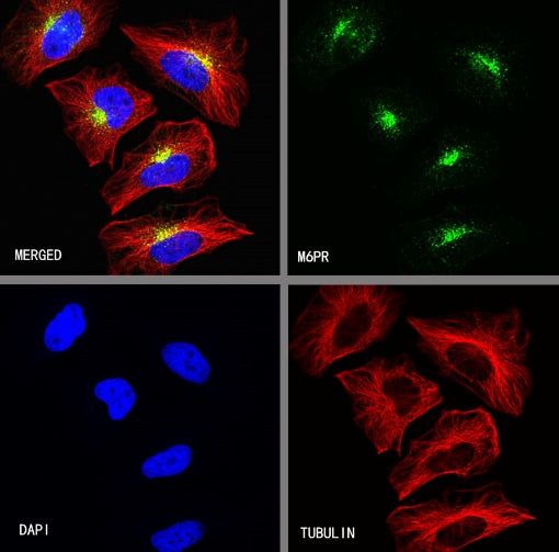 M6PR Recombinant Rabbit mAb (S-1480-21)
