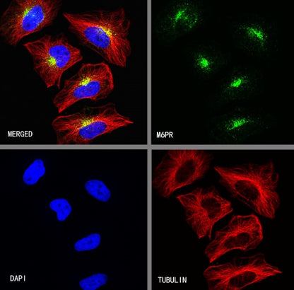 M6PR Recombinant Rabbit mAb (S-1480-21)