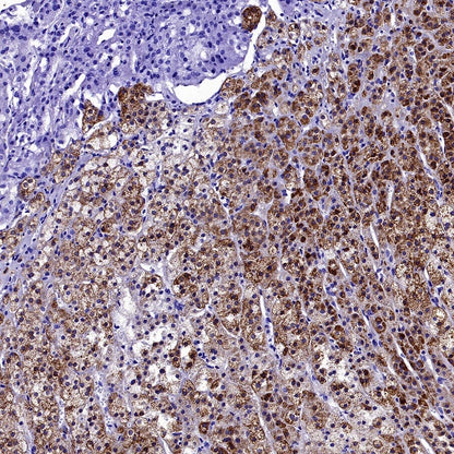 StAR Recombinant Rabbit mAb (S-2520-24)