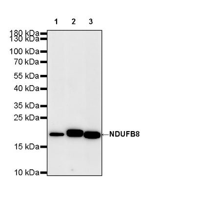 NDUFB8 Recombinant Rabbit mAb (S-4770-29)