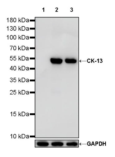CK-13 Recombinant Rabbit mAb (SDT-R282)