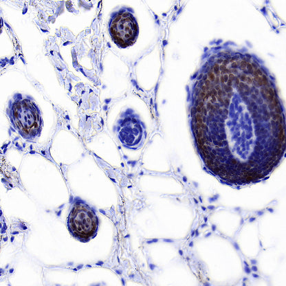 DLX3 Recombinant Rabbit mAb (S-4140-2)