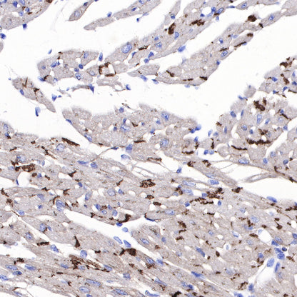 N-Cadherin Recombinant Rabbit mAb (SDT-329-12)
