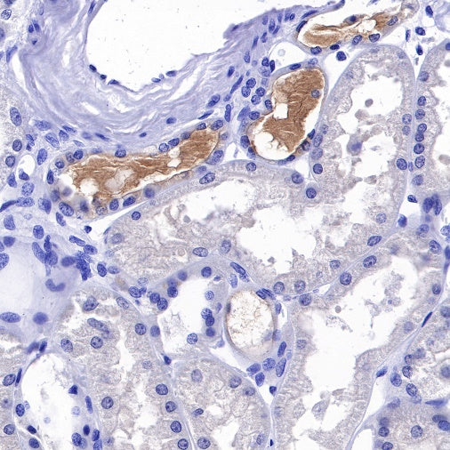 C1q Recombinant Rat mAb (S-R189)