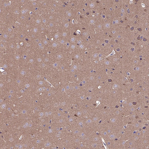 TSG101 Recombinant Rabbit mAb (S-1868-76)