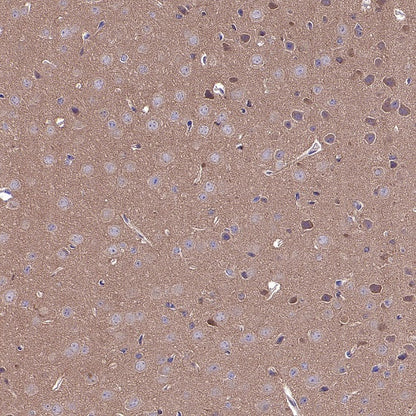 TSG101 Recombinant Rabbit mAb (S-1868-76)