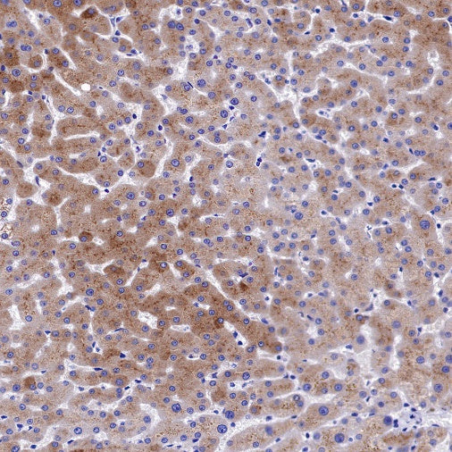 FGL1 Recombinant Rabbit mAb (S-1409-109)