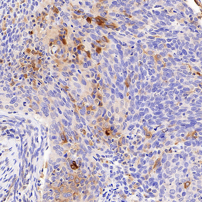 IFIT2 Recombinant Rabbit mAb (S-6029)